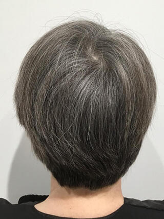 Foto "antes": vista trasera de una mujer con cabello negro corto con muchas canas antes de la coloración.