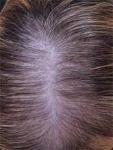 before results image