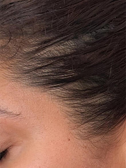 before results image