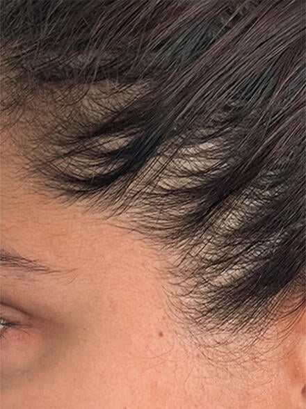before results image