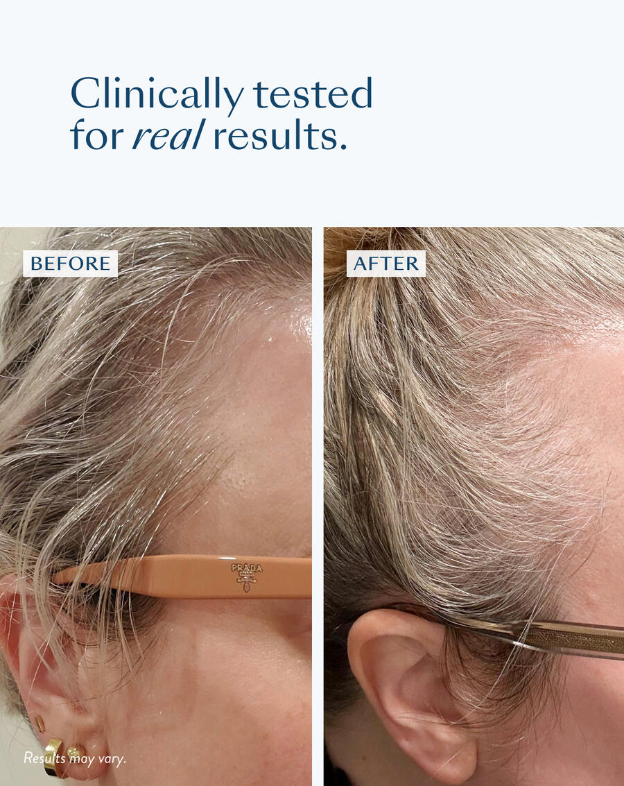 Densifying Scalp Serum